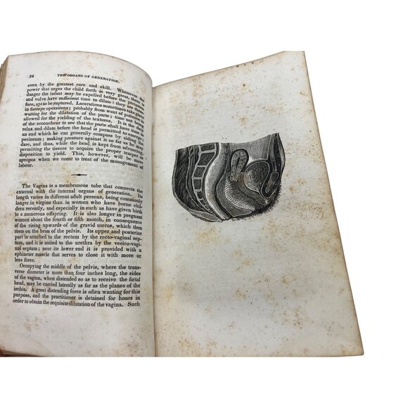 1838 The Philadelphia Practice of Midwifery Charles D Meigs First Ed Illustrated - Picture 7 of 12